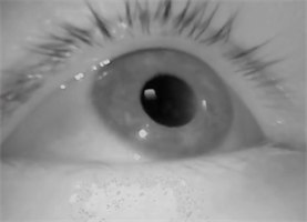 Eye clearly visible in the camera view