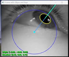 Pupil ellipse eye center and gaze line overlay